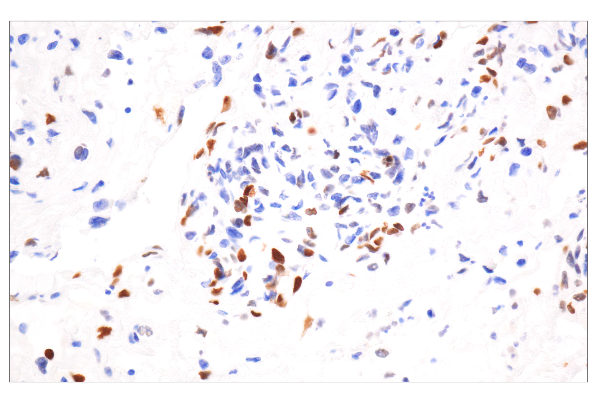 Immunohistochemistry Image 1: Phospho-Histone H2A.X (Ser139) (20E3) Rabbit mAb