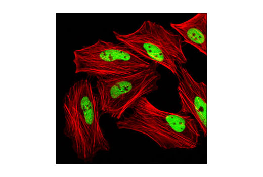 Immunofluorescence Image 1: Di-Methyl-Histone H3 (Lys4) Antibody