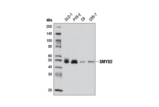  Image 10: Lysine Methyltransferase Antibody Sampler Kit