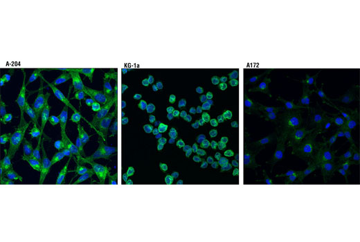 Immunofluorescence Image 1: FGF Receptor 1 (D8E4) XP® Rabbit mAb