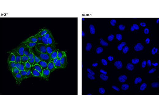 Immunofluorescence Image 1: IGF-I Receptor β (D23H3) XP® Rabbit mAb