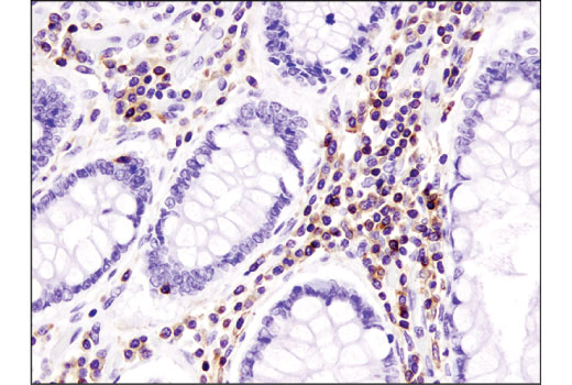 Immunohistochemistry Image 1: CXCR4 (D4Z7W) Rabbit mAb