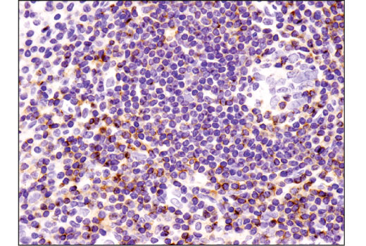 Immunohistochemistry Image 3: CXCR4 (D4Z7W) Rabbit mAb