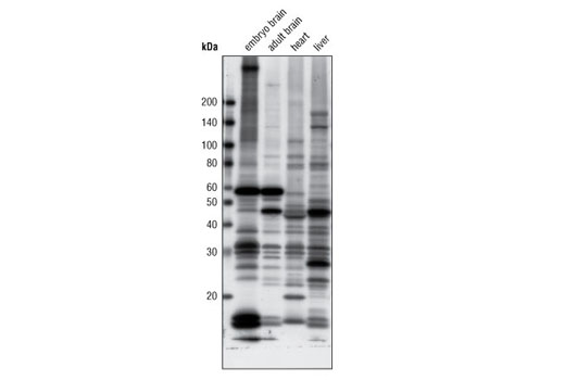 Western Blotting Image 2: Acetylated-Lysine (Ac-K2-100) MultiMab®  Rabbit mAb mix