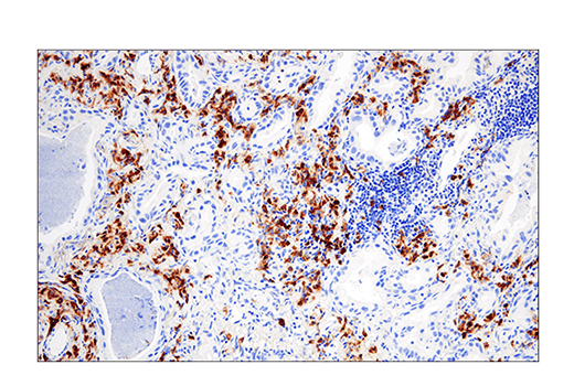 Immunohistochemistry Image 1: CRACC/SLAMF7/CD319 (E5C4M) Rabbit mAb (BSA and Azide Free)