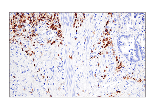Immunohistochemistry Image 5: CRACC/SLAMF7/CD319 (E5C4M) Rabbit mAb (BSA and Azide Free)