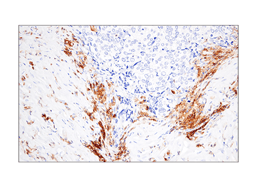Immunohistochemistry Image 4: CRACC/SLAMF7/CD319 (E5C4M) Rabbit mAb (BSA and Azide Free)