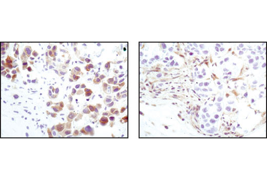 Immunohistochemistry Image 4: PTEN (138G6) Rabbit mAb (BSA and Azide Free)