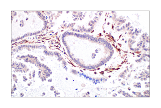 Immunohistochemistry Image 11: PTEN (138G6) Rabbit mAb (BSA and Azide Free)