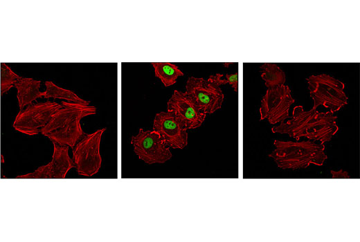 Immunofluorescence Image 2: Phospho-c-Fos (Ser32) (D82C12) XP® Rabbit mAb (BSA and Azide Free)