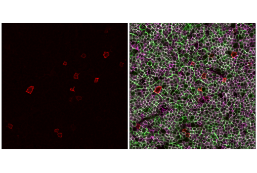 Immunofluorescence Image 1: IL-2Rα/CD25 (E9W2J) XP® Rabbit mAb (Alexa Fluor® 555 Conjugate)