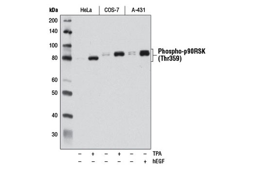 使用 Phospho-p90RSK (Thr359) (D1E9) 对饥饿过夜后，未经处理 (-) 或已经 (+) TPA #（200 nM，15 分钟）或 Human Epidermal Growth Factor (hEGF) #（100 nM，15 分钟）处理的 HeLa、COS-7 和 A-431 细胞的提取物进行蛋白质印迹分析。
