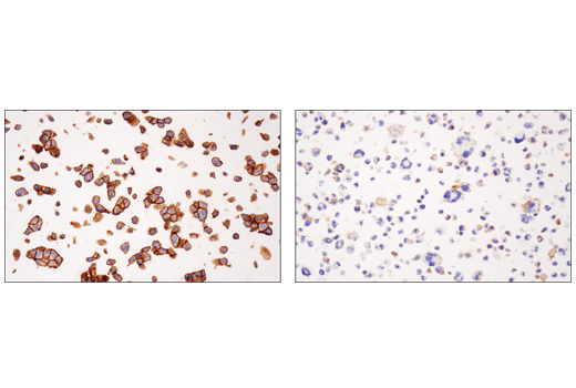 使用 Nectin-2/CD112 (D8D3F) 对石蜡包埋的 RT4 细胞团块（左图，高表达）或 HDLM-2 细胞团块（右图，低表达）进行免疫组织化学分析。