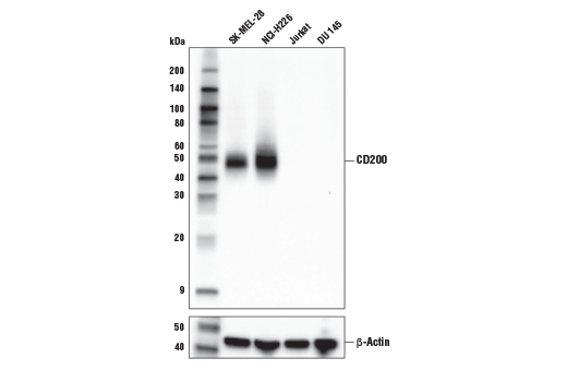 使用 CD200 (E5I9V)（上图）或 β-Actin (D6A8)（下图）对不同细胞系的提取物进行蛋白质印迹分析。