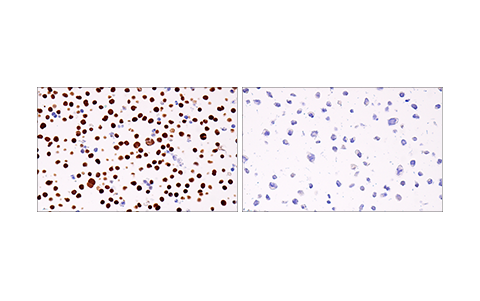 使用 Helios (E4L5U) Rabbit mAb 对石蜡包埋的 Jurkat 细胞沉淀物（左图，阳性）或 RL 细胞沉淀物（右图，阴性）进行免疫组织化学分析。