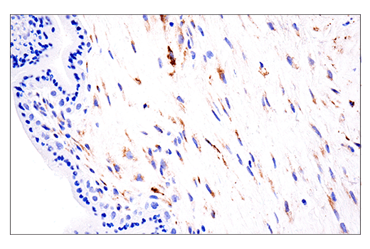 Immunohistochemistry Image 5: LOXL2 (E3P7Y) Rabbit mAb (BSA and Azide Free)