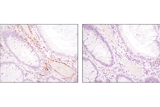 undefined Image 28: Angiogenesis Antibody Sampler Kit