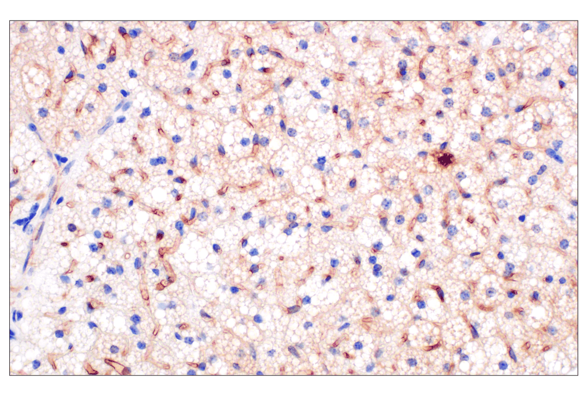 Immunohistochemistry Image 2: PNPLA3 (E7N6O) Rabbit mAb