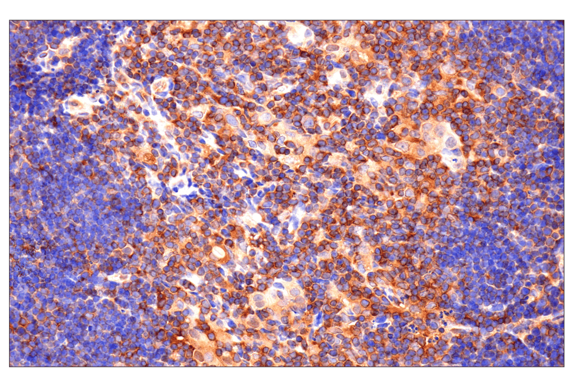 Immunohistochemistry Image 8: Caspase-8 (F5K9P) Rabbit mAb (BSA and Azide Free)