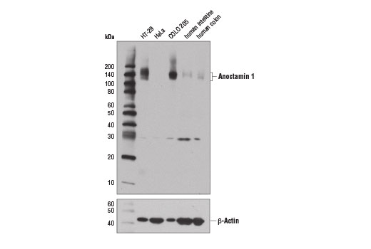 Western Blotting Image 1: DOG1/Anoctamin 1 (D1M9Q) Rabbit mAb