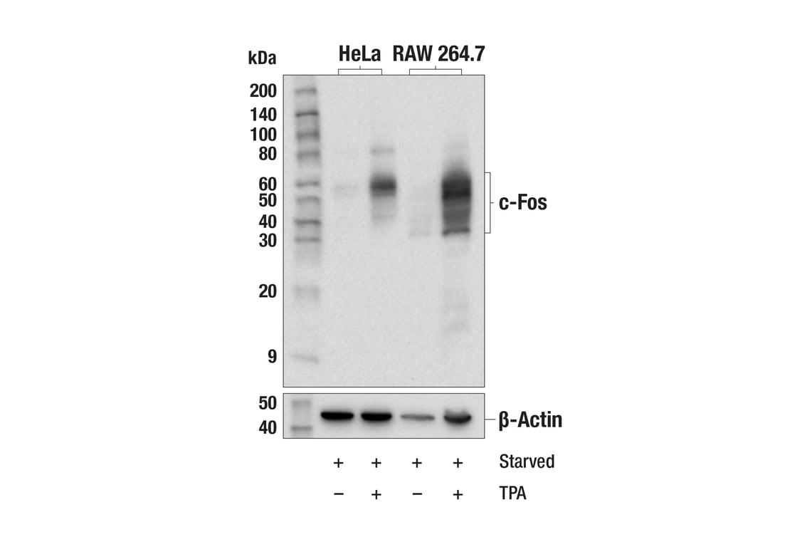 Western Blotting Image 1: c-Fos (E2I7R) XP<sup>®</sup> Rabbit mAb