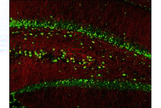 undefined Image 48: Microglia Cross Module Antibody Sampler Kit