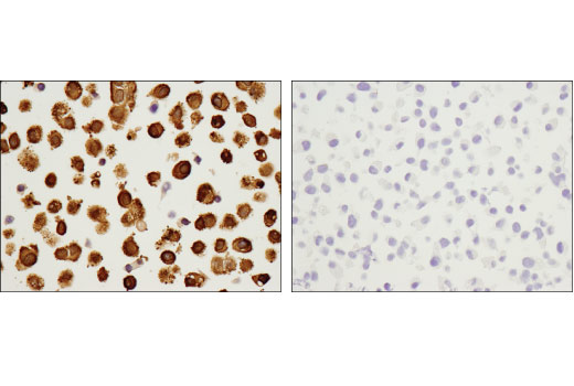 Immunohistochemistry Image 4: ASS1 (D4O4B) XP<sup>®</sup> Rabbit mAb