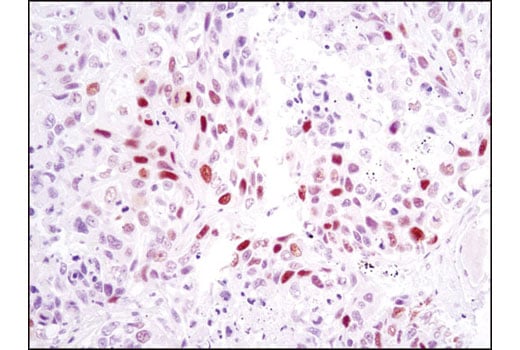 Immunohistochemistry Image 1: Skp2 (D3G5) XP<sup>®</sup> Rabbit mAb