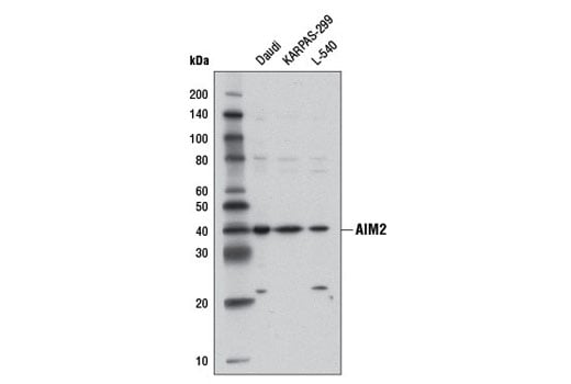 undefined Image 3: Human Reactive Inflammasome Antibody Sampler Kit II