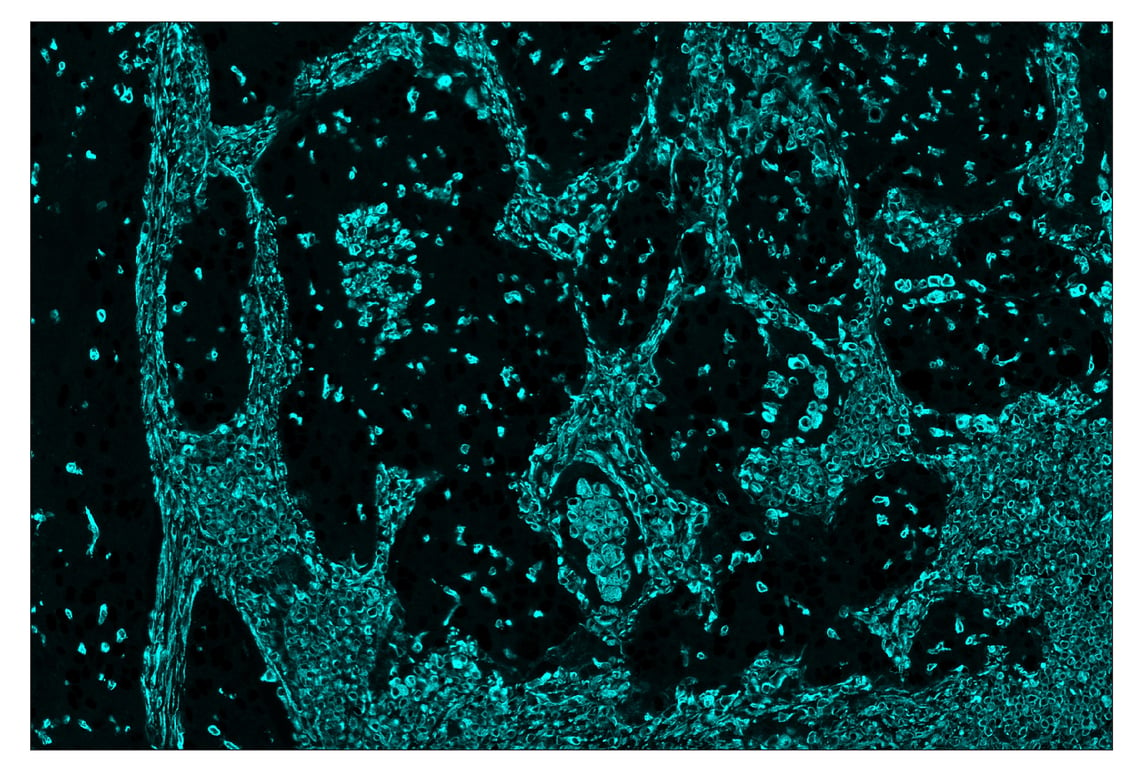 Immunohistochemistry Image 5: Vimentin (D21H3) & CO-0012-647 SignalStar<sup>™</sup> Oligo-Antibody Pair