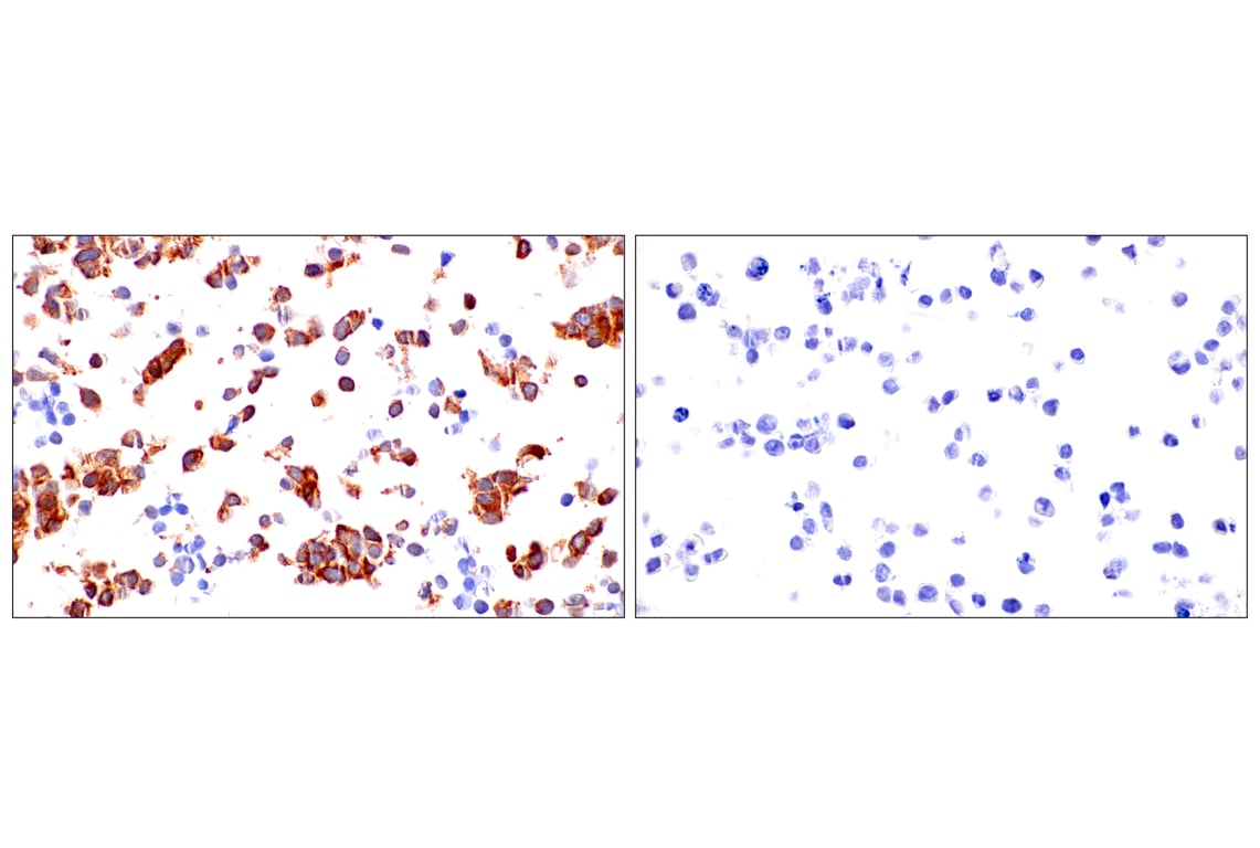 Immunohistochemistry Image 14: Phospho-YAP (Ser61) (E4Q8S) Rabbit mAb