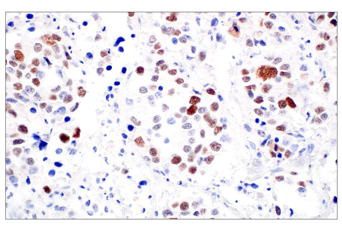 Immunohistochemistry Image 5: BRCA1 (E5S9G) Rabbit mAb