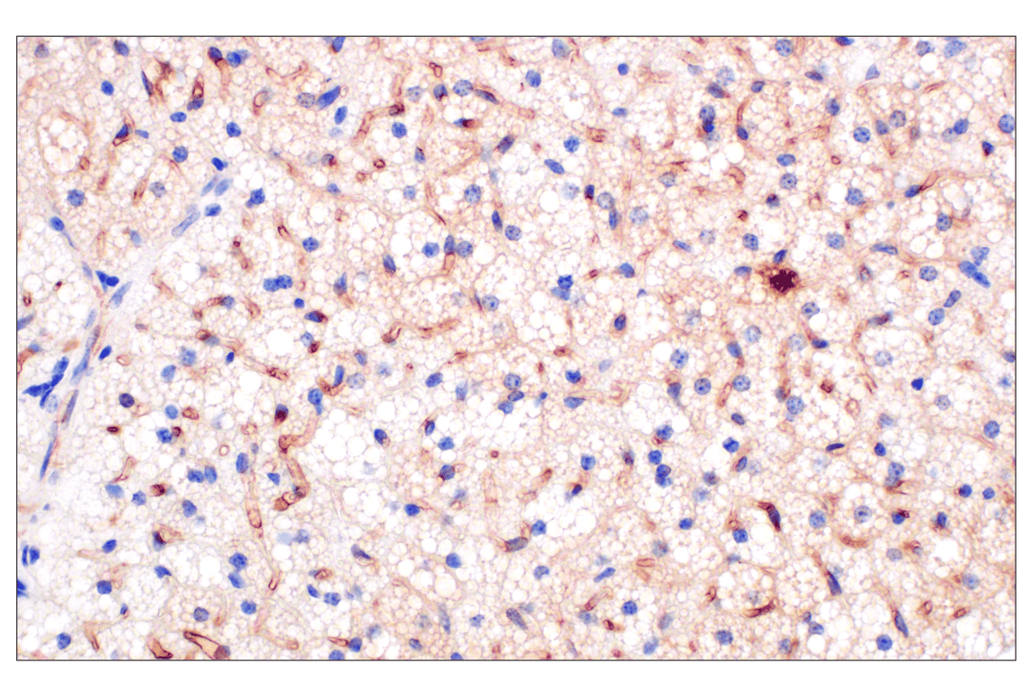 Immunohistochemistry Image 2: PNPLA3 (E7N6O) Rabbit mAb (BSA and Azide Free)
