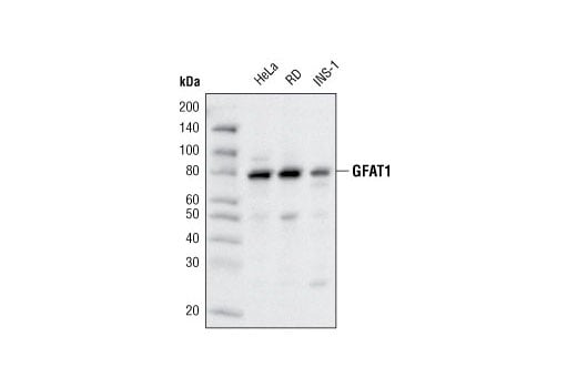 undefined Image 3: Glutamine Metabolism Antibody Sampler Kit