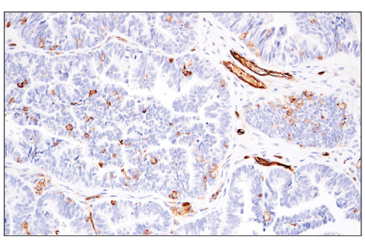Immunohistochemistry Image 4: CD141/Thrombomodulin (E7Y9P) XP<sup>®</sup> Rabbit mAb