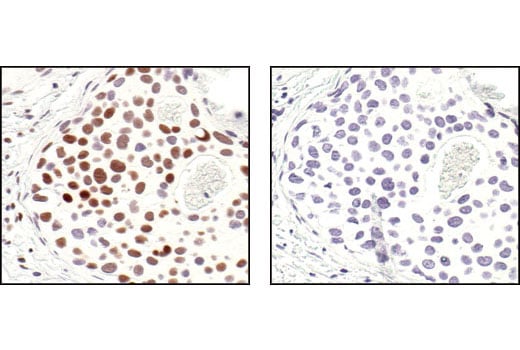 undefined Image 55: Cannabinoid Receptor 1 Downstream Signaling Antibody Sampler Kit