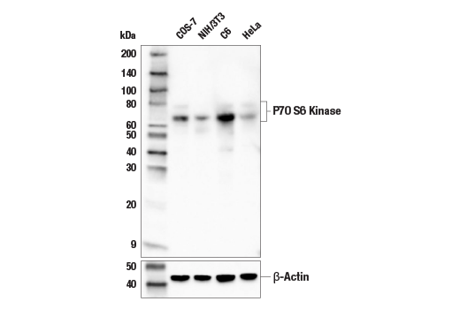 Western Blotting Image 2: p70 S6 Kinase (E8K6T) XP<sup>®</sup> Rabbit mAb