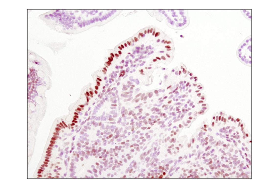 undefined Image 23: Stat3/Stat5 Signaling Antibody Sampler Kit