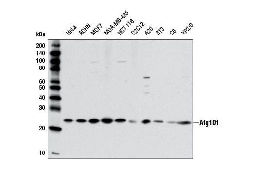 undefined Image 3: Autophagy Induction (ULK1 Complex) Antibody Sampler Kit