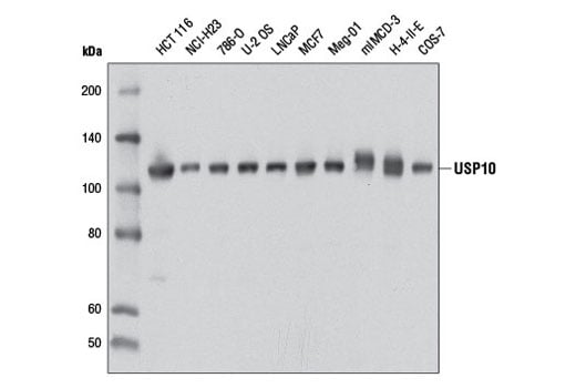 Western Blotting Image 2: USP10 (D7A5) Rabbit mAb