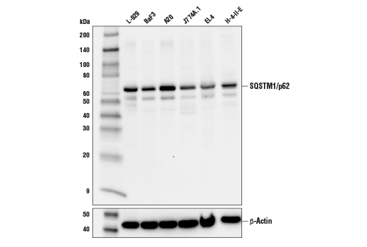 Western Blotting Image 3: SQSTM1/p62 (D6M5X) Rabbit mAb