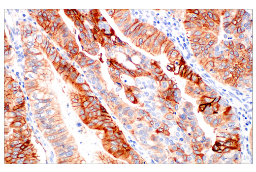 Immunohistochemistry Image 3: Integrin β6 (E4M9P) XP<sup>®</sup> Rabbit mAb