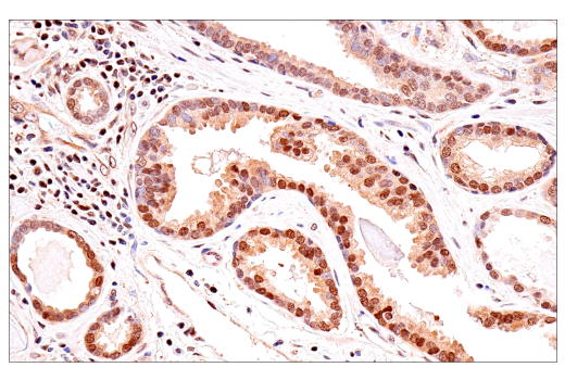 Immunohistochemistry Image 3: p70 S6 Kinase (E8K6T) XP<sup>®</sup> Rabbit mAb