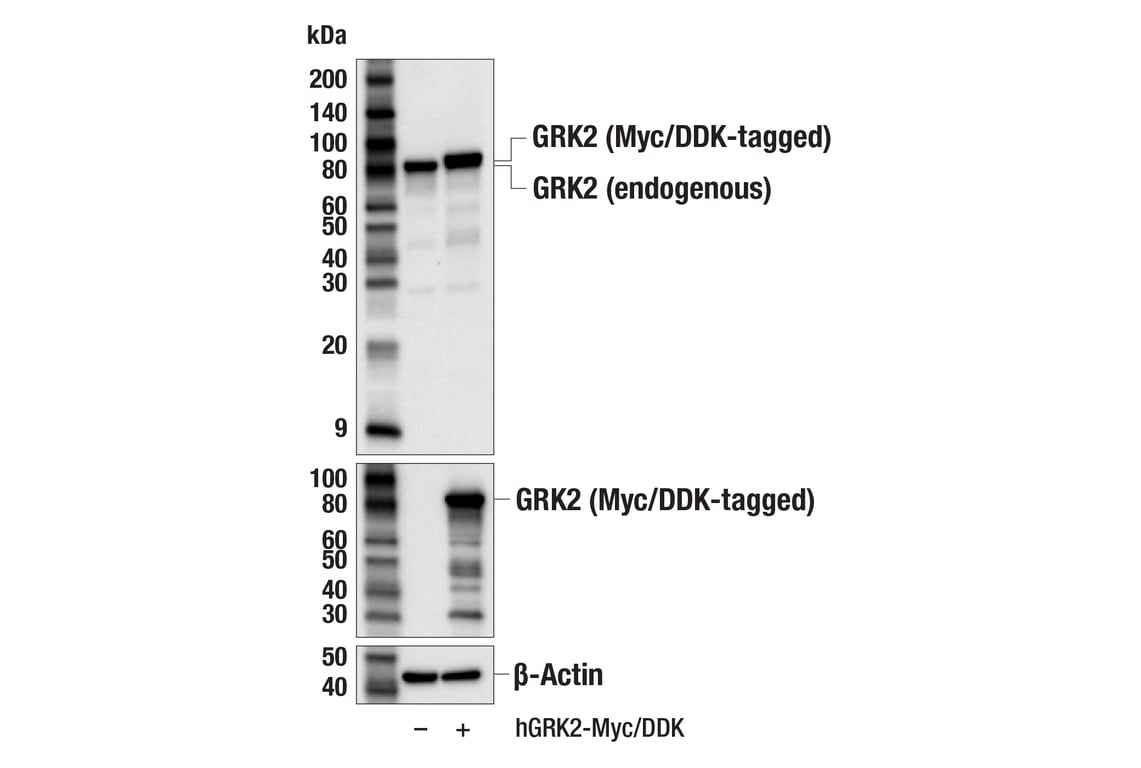Western Blotting Image 3: GRK2 (E8A7E) Rabbit mAb