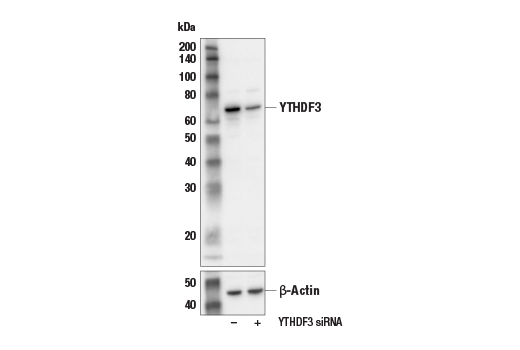 Western Blotting Image 1: YTHDF3 Antibody