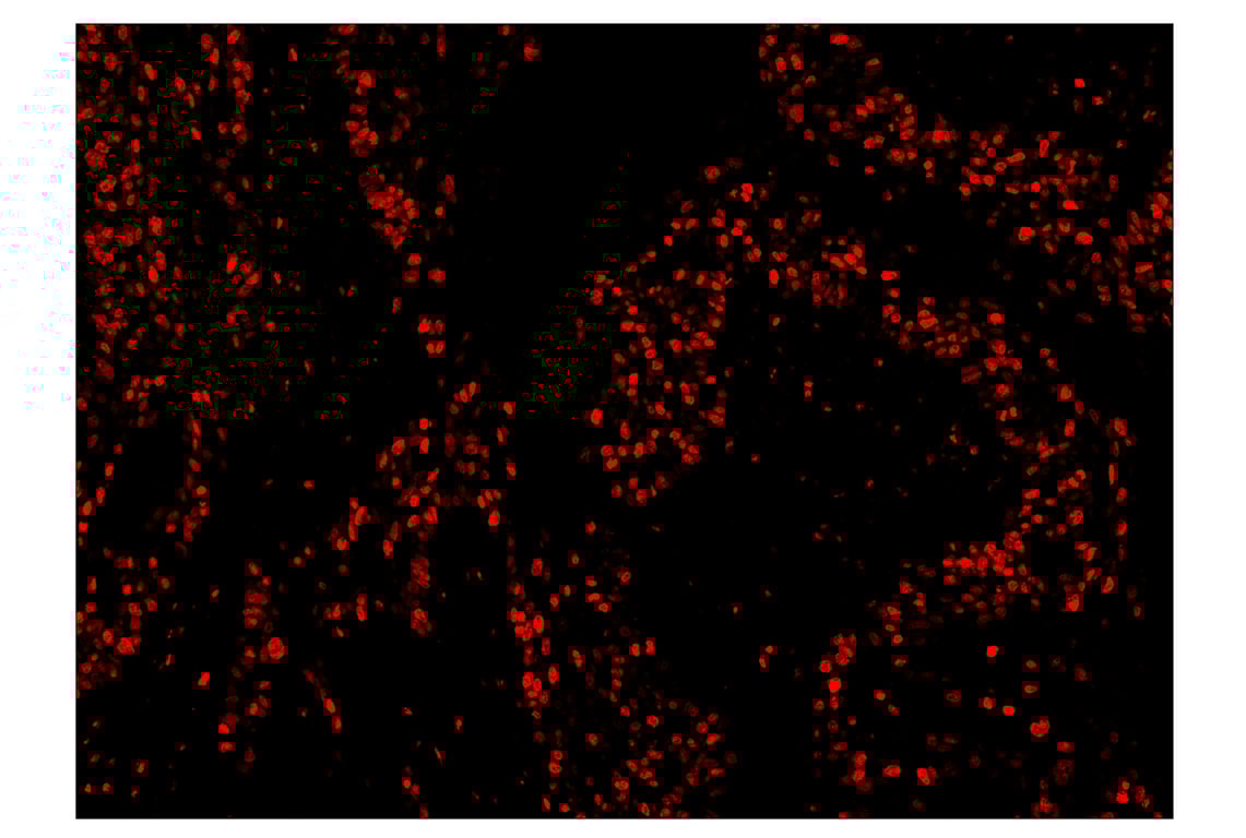 Immunohistochemistry Image 4: Ki-67 (8D5) & CO-0014-647 SignalStar<sup>™</sup> Oligo-Antibody Pair