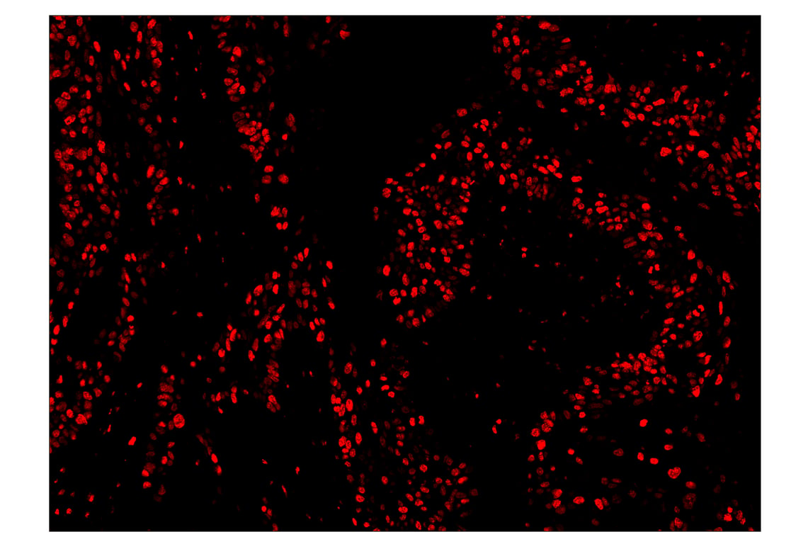 Immunohistochemistry Image 4: Ki-67 (8D5) & CO-0014-647 SignalStar<sup>™</sup> Oligo-Antibody Pair