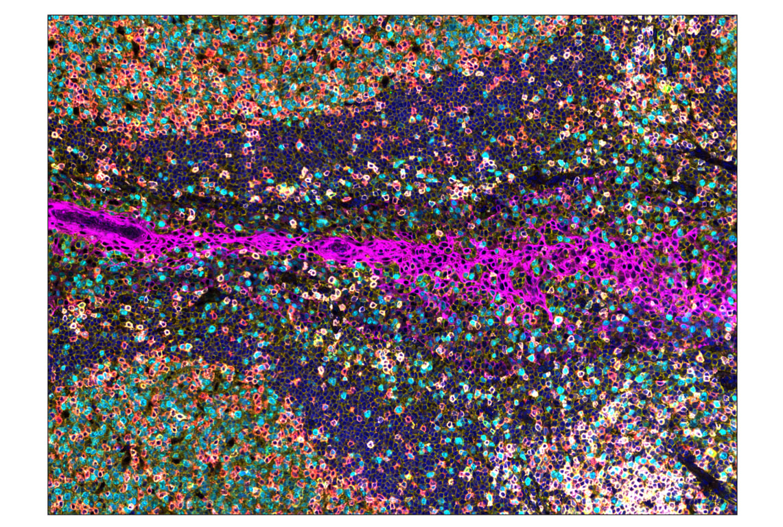 Immunohistochemistry Image 1: CD20 (E7B7T) & CO-0011-750 SignalStar<sup>™</sup> Oligo-Antibody Pair