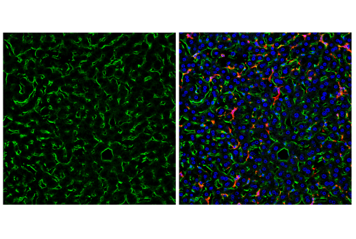 Immunofluorescence Image 2: CD38 (E9F5A) XP<sup>®</sup> Rabbit mAb