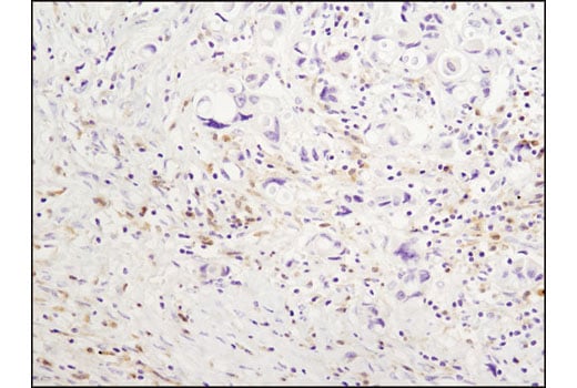 undefined Image 19: B Cell Signaling Antibody Sampler Kit II